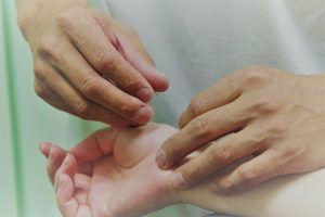 痛くないはり鍼治療